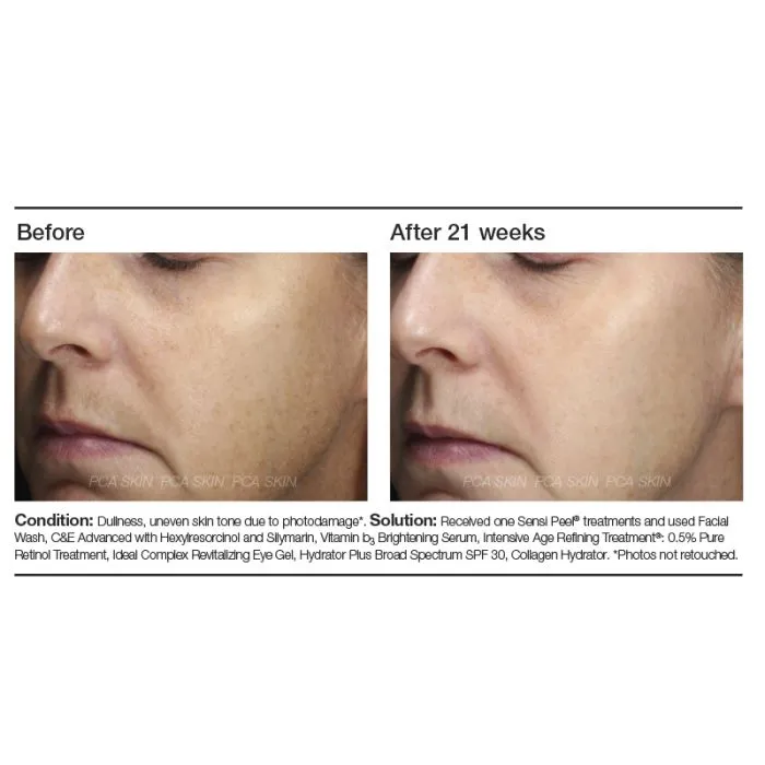 PCA Skin Vitamin B3 Brightening Serum